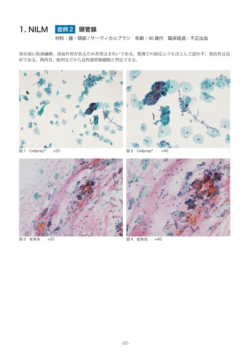 婦人科子宮頚部細胞診 第3章